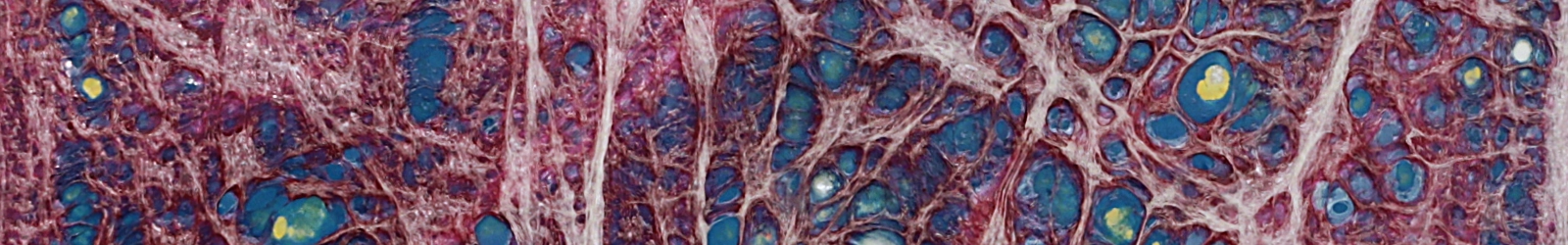 Ausschnitt eines Bildes, auf dem geschmolzene, farbige Folien eine Art Netzstruktur bilden, wie von einem menschlichen Gewebe. | konzeptdesignkunst Ausschnitt eines Bildes, auf dem geschmolzene, farbige Folien eine Art Netzstruktur bilden, wie von einem menschlichen Gewebe. | konzeptdesignkunst